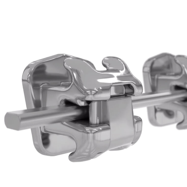 Ästhetische Korrektur - feste kieferorthopädische Zahnspange (KIG 1-2)