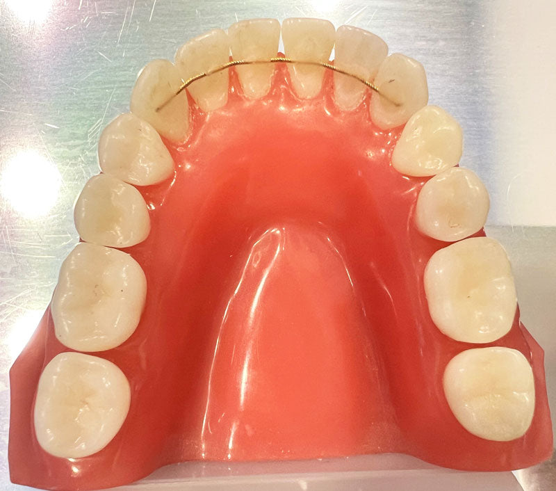 Schnarcherschiene von Dr. Stil